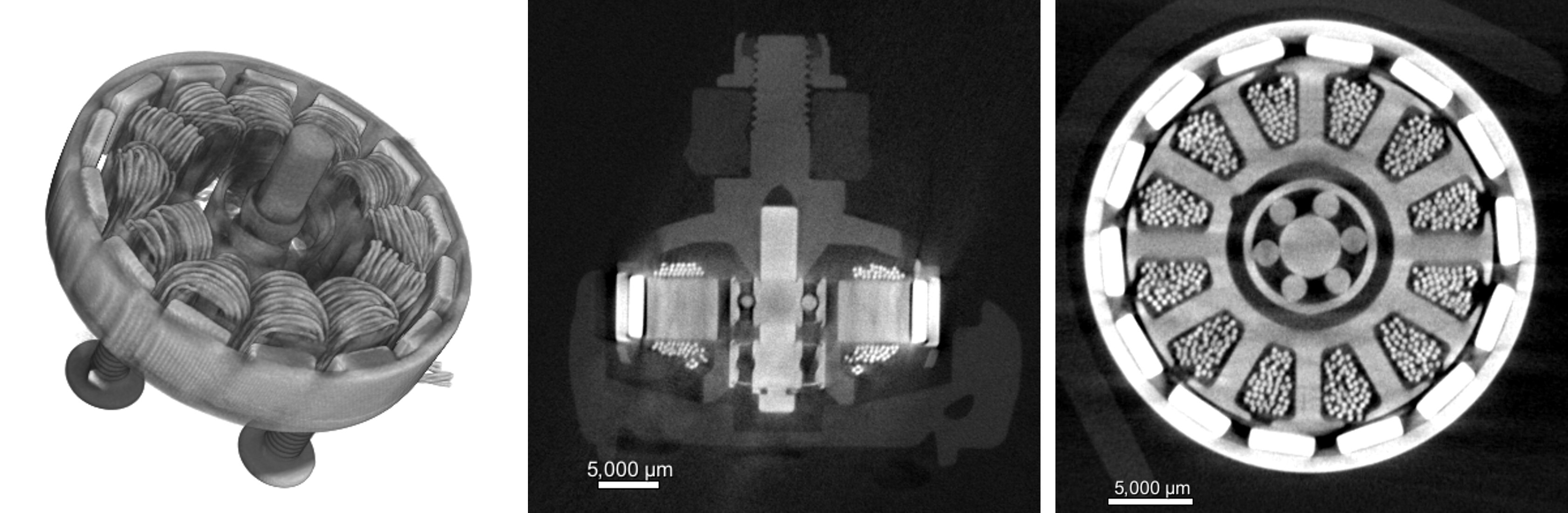 XRI1032 Figure 5 - Motor Assessment