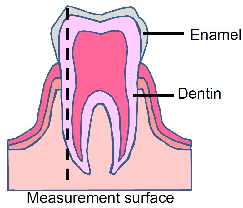 B-XRD1122 Figure 1 Structure of a human tooth 