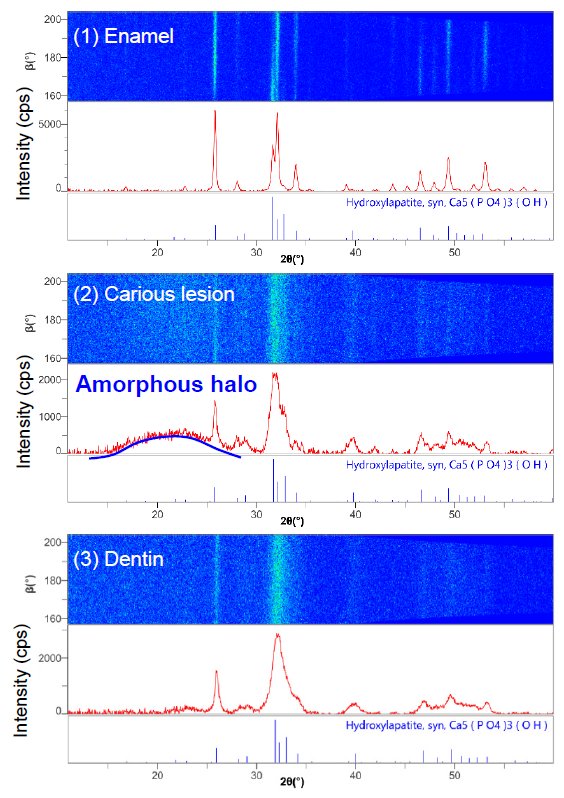 B-XRD1122 Figure 3 2D diffraction patterns, 1D conversion profiles, and qualitative analysis results