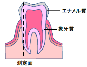 ヒトの歯の構造