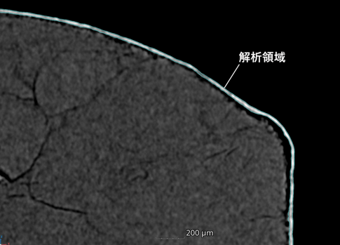 図1：解析領域の指定（断層画像）