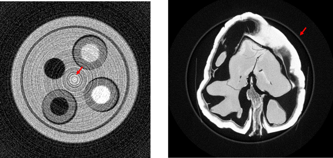 Illustration of ring artifacts-1