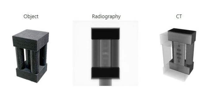 2D radiograph and 3D CT reconstruction